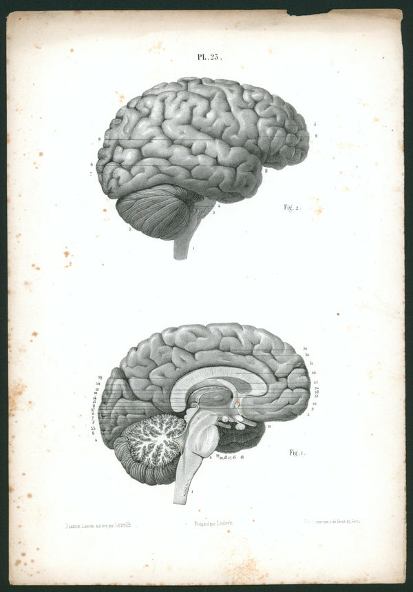 Human Brain- Anatomy - Authentic Vintage Antique Print