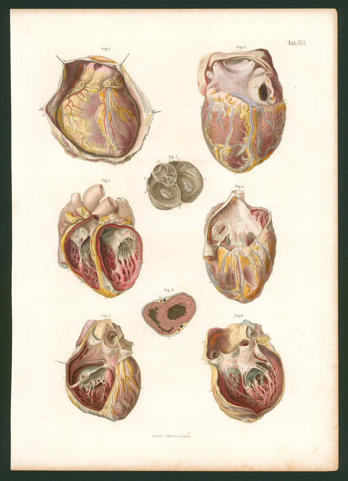 Cardiovascular Engraving - Authentic Vintage Antique Print