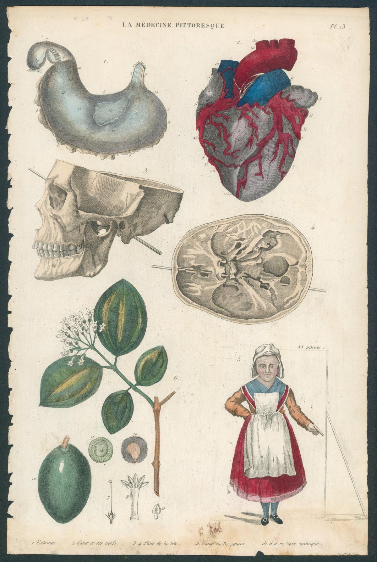 Plate 13