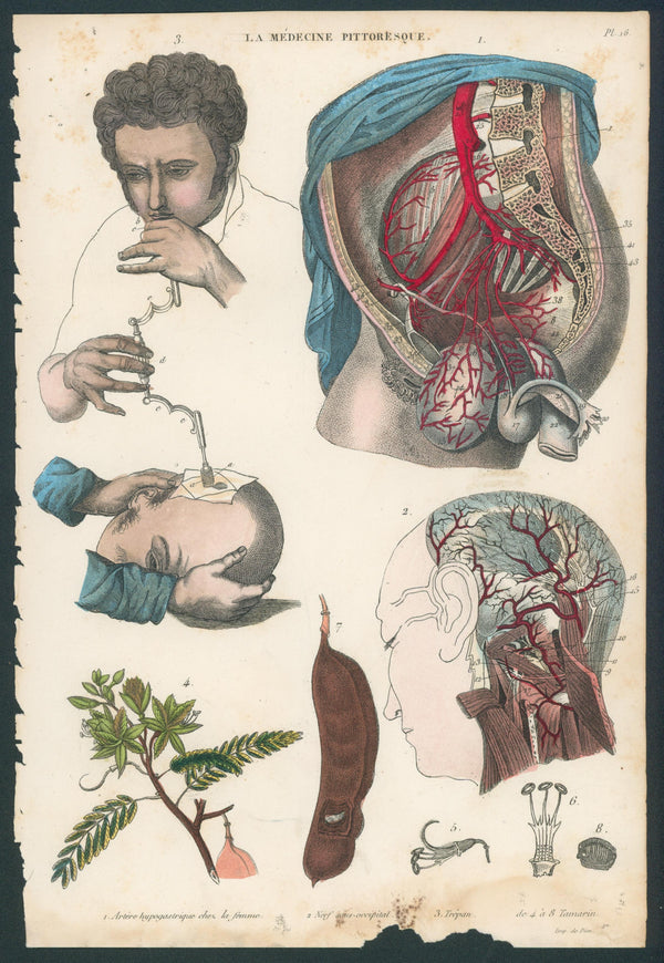Plate 16