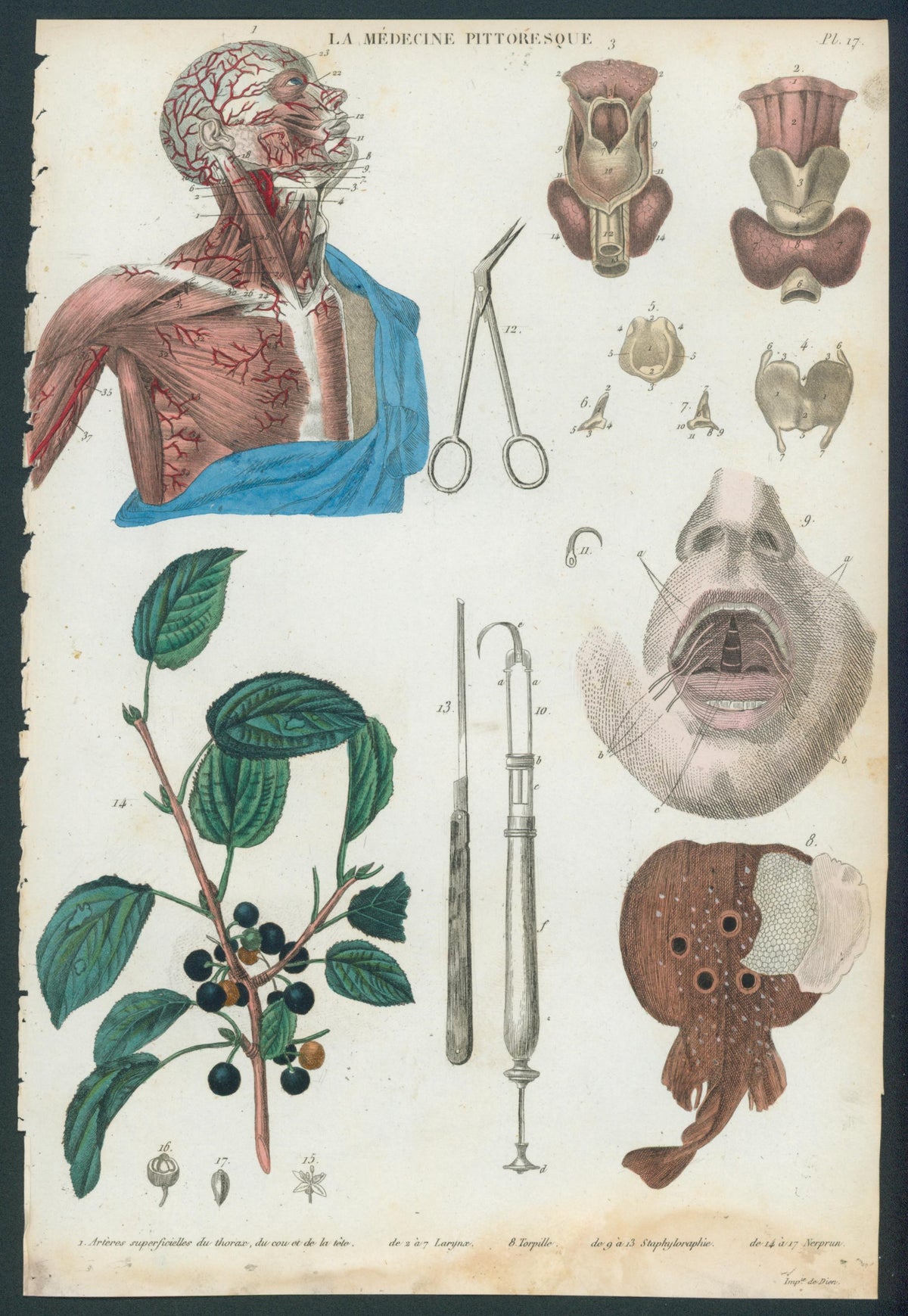 Plate 17