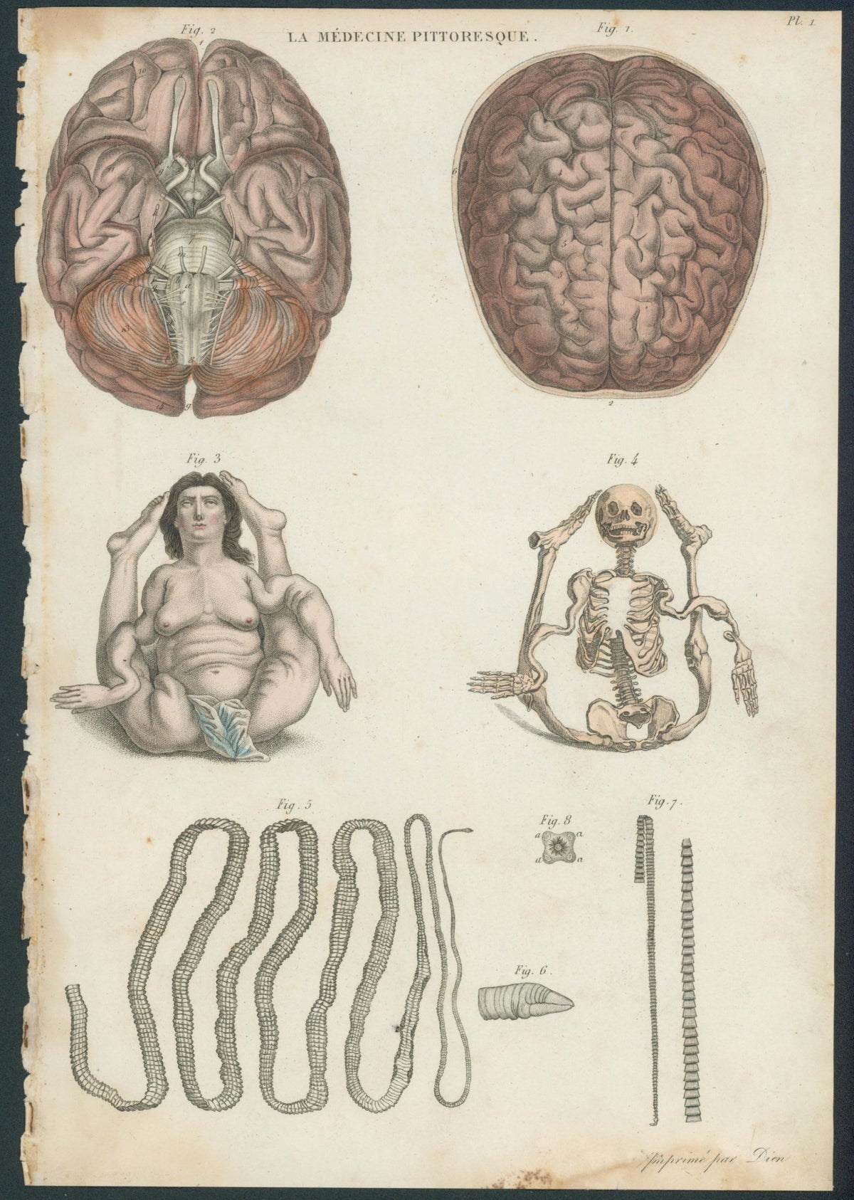 Plate 1
