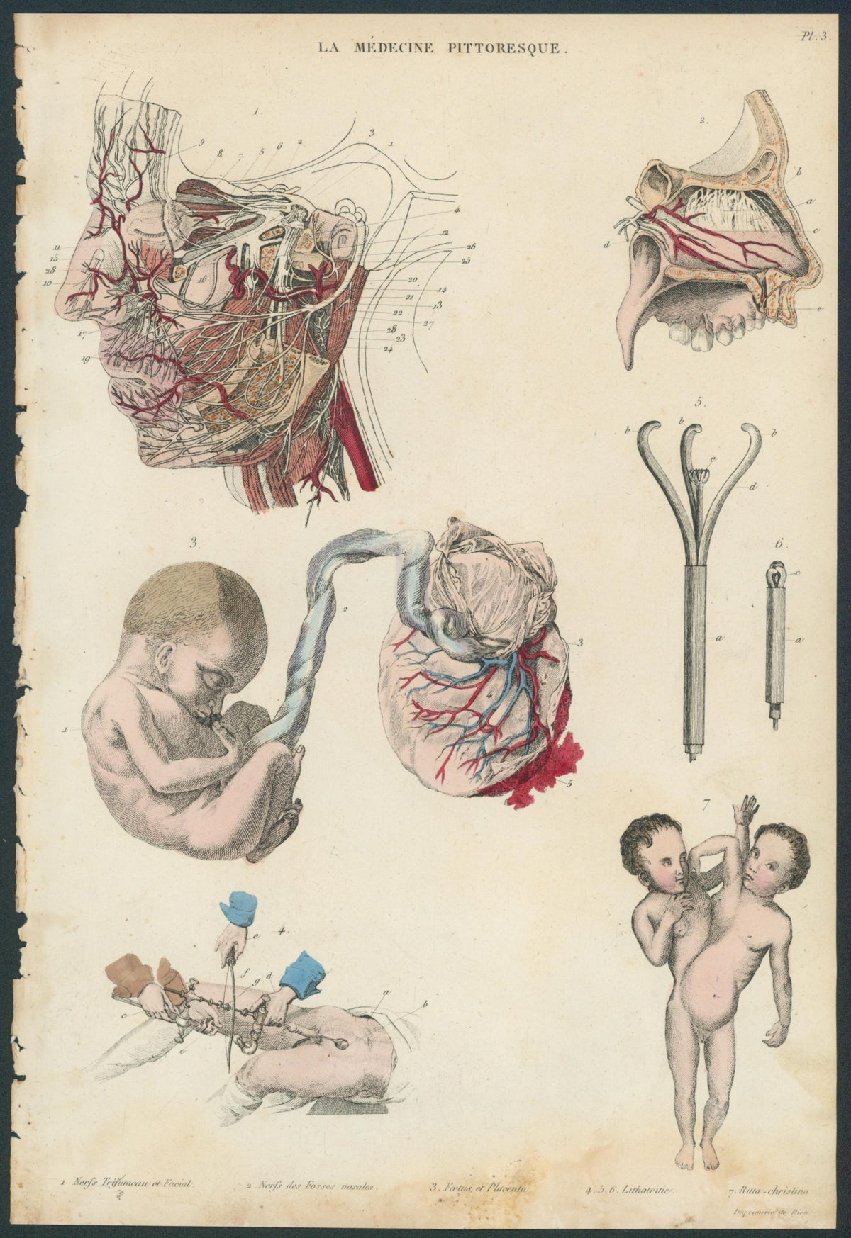 Plate 3