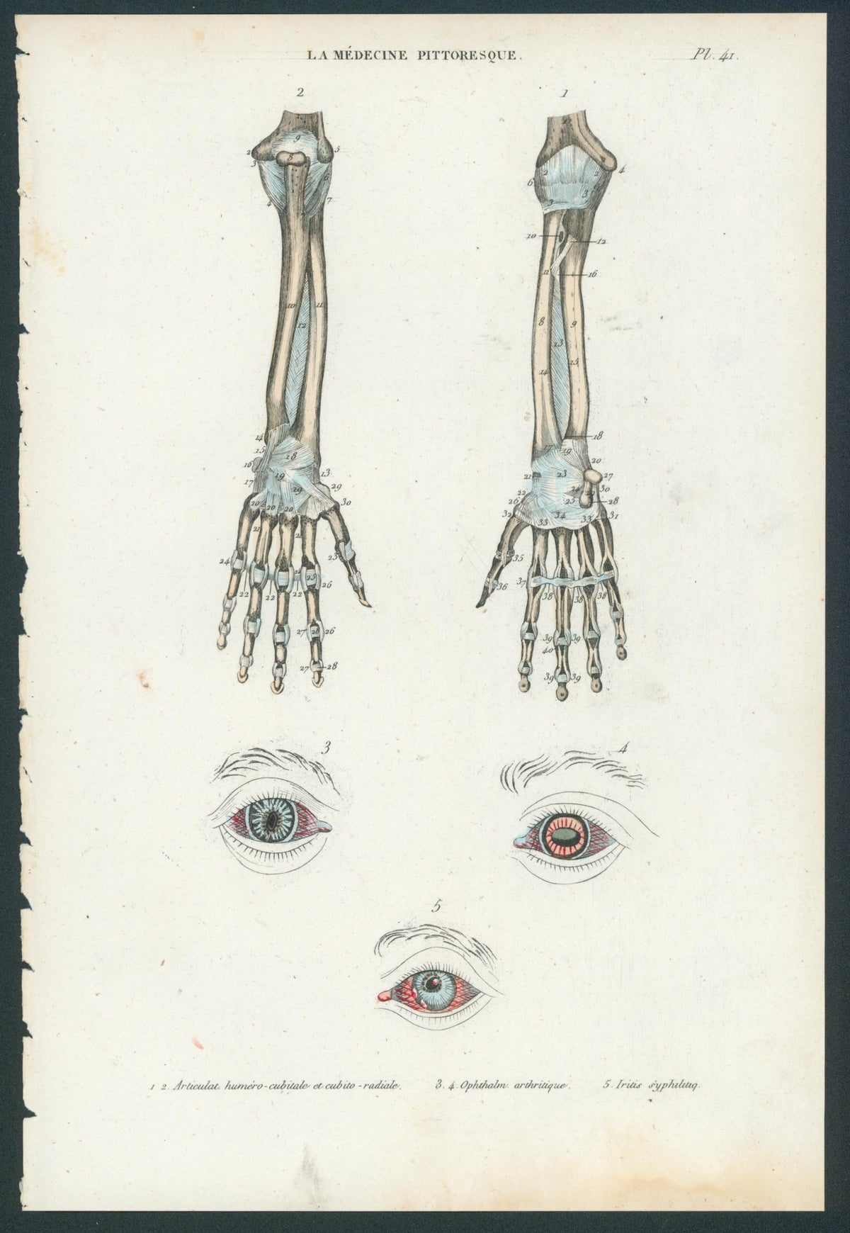 Plate 41