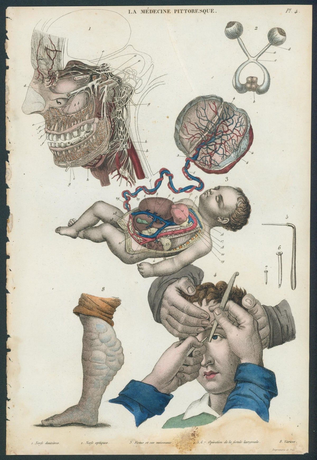 Plate 4