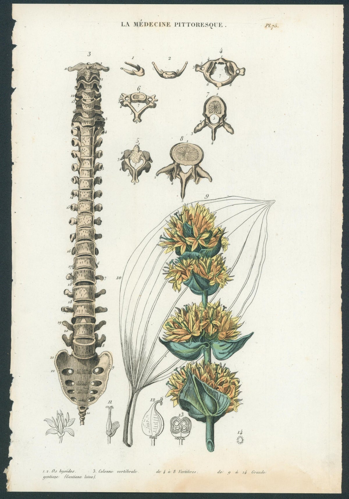 Plate 75