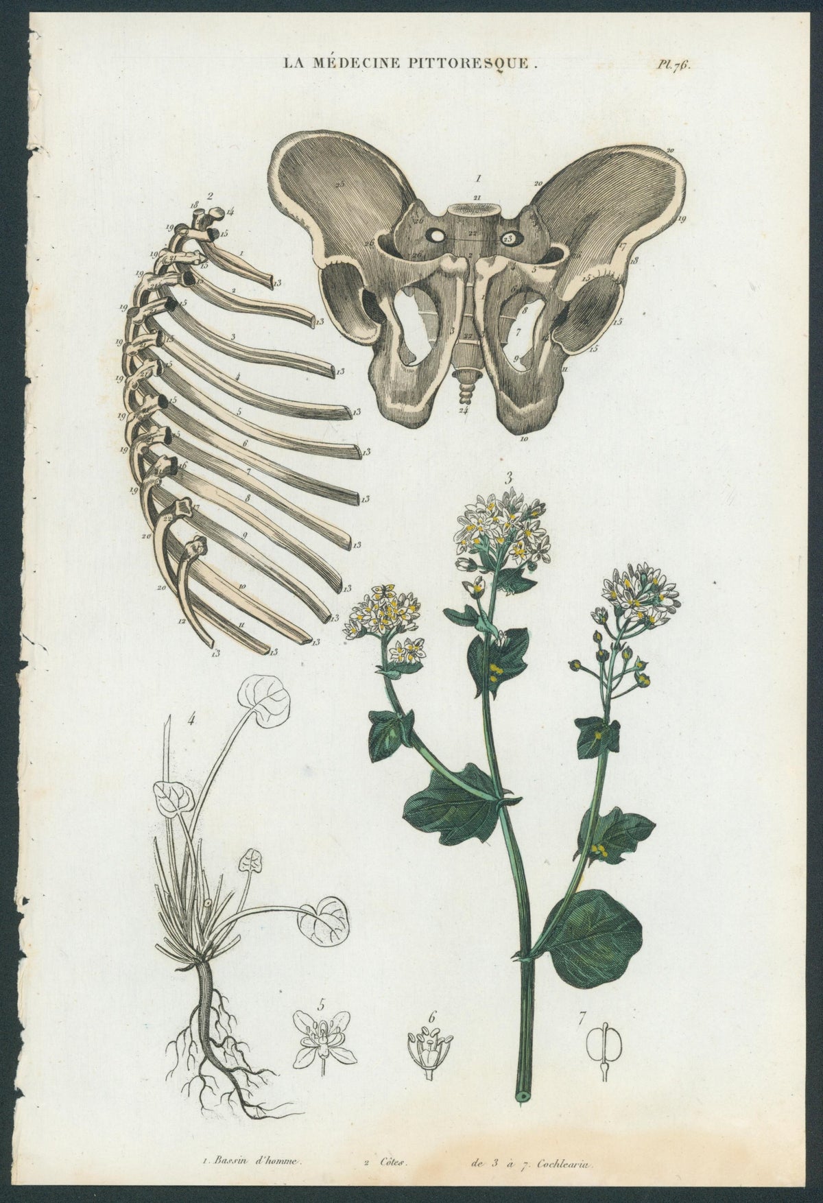 Plate 76