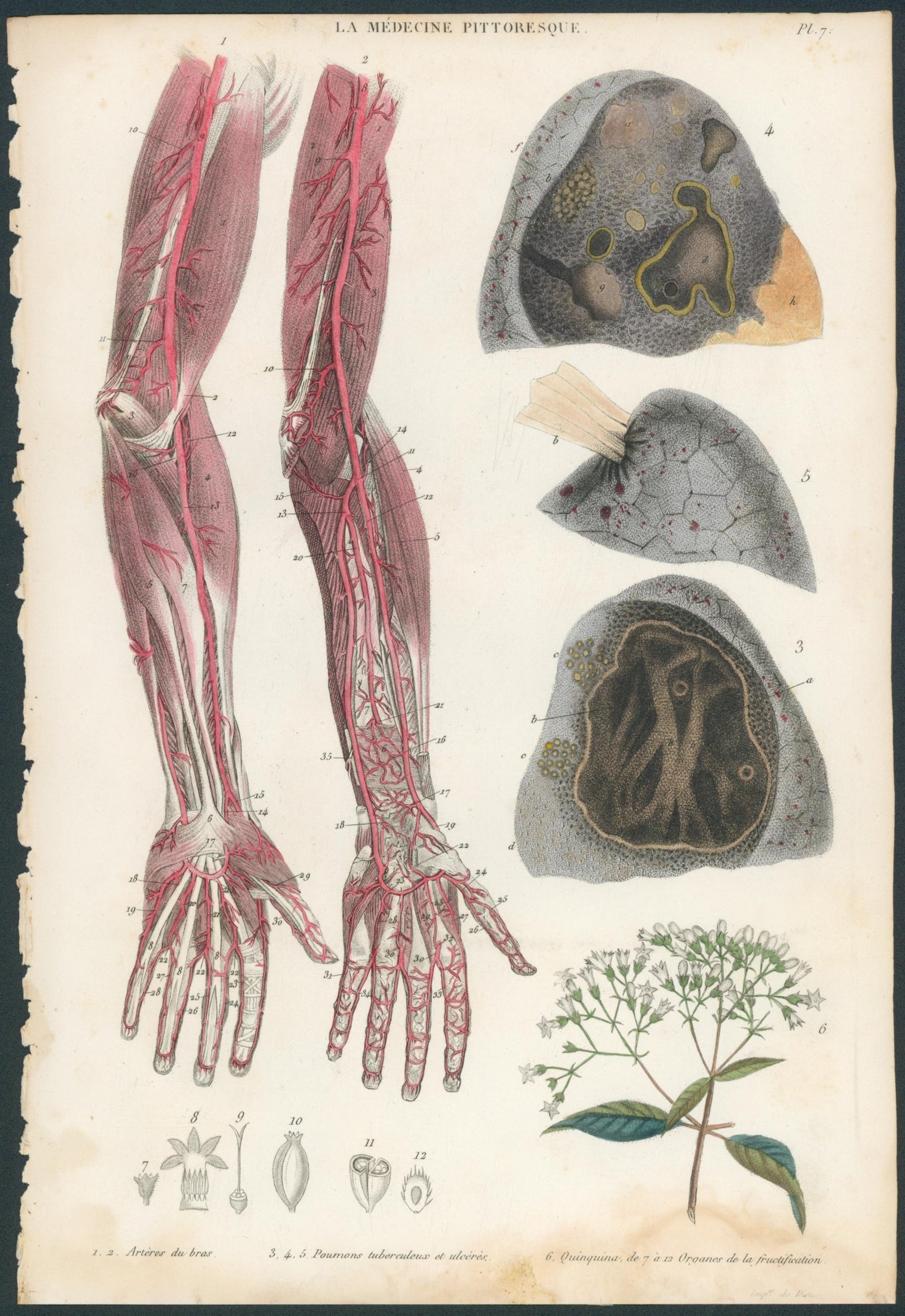 Plate 7